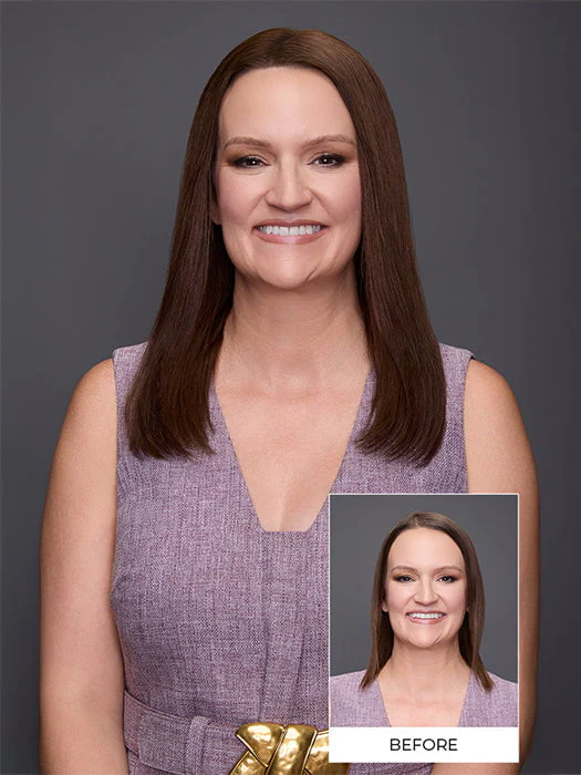 23382-easipart-xl-wide-hh-14-human-hair-topper-mono-top-1.webp easiPart XL Wide HH 14” | Human Hair Topper (Mono Top)